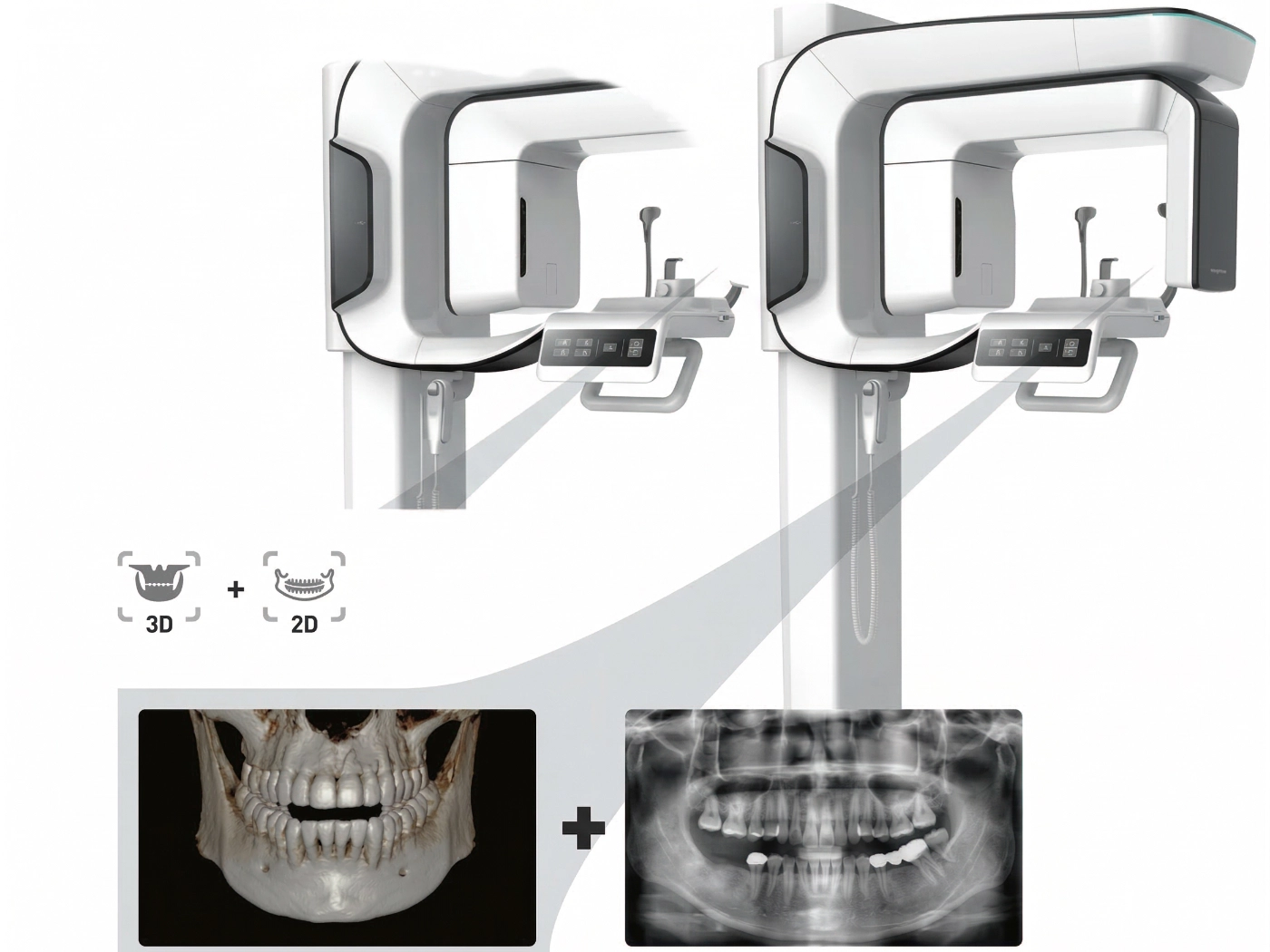 tac-panormaica-dentale-per-diagnostica-dentale-cantù