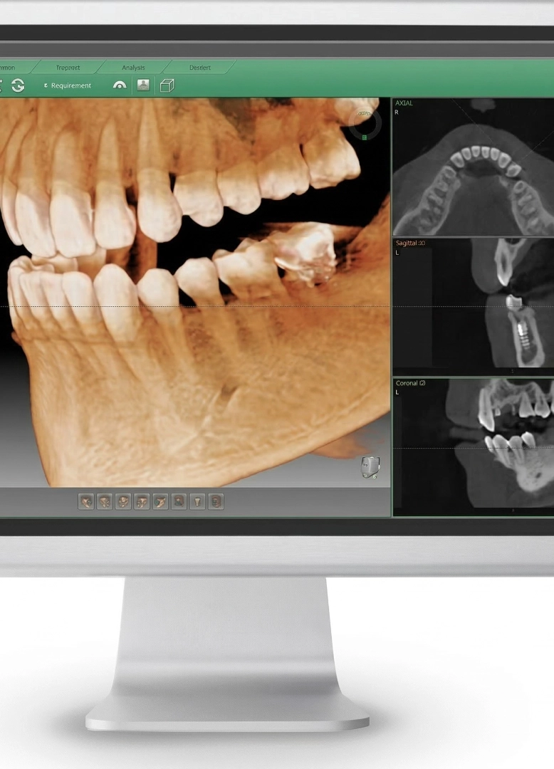 trattamenti-cure-dentali-monza-brianza