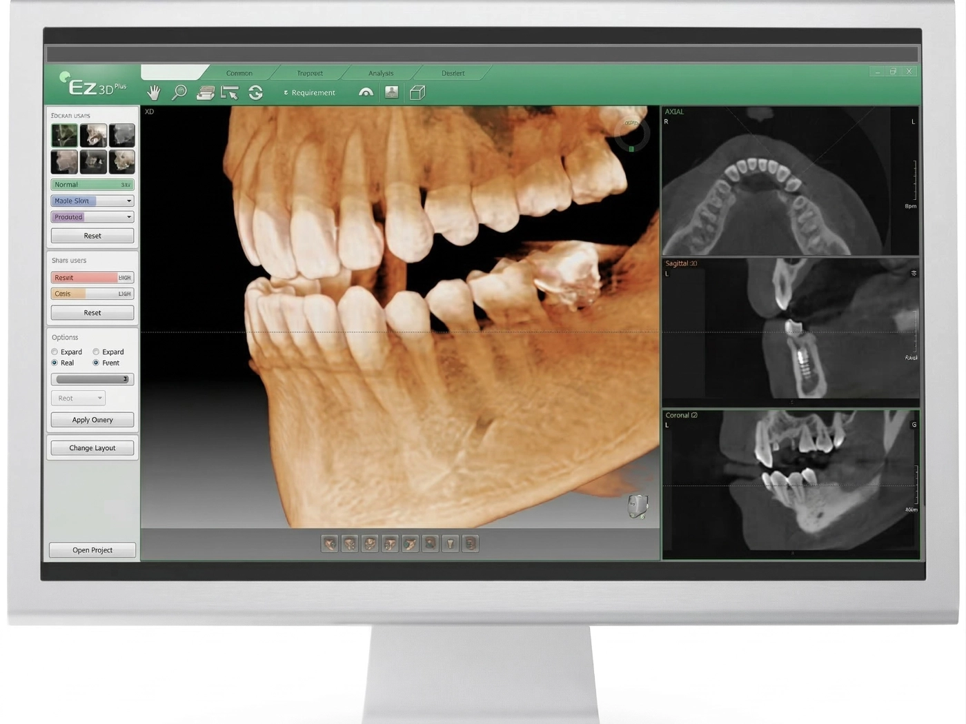 visualizzazione-schermo-radiografia-ossea