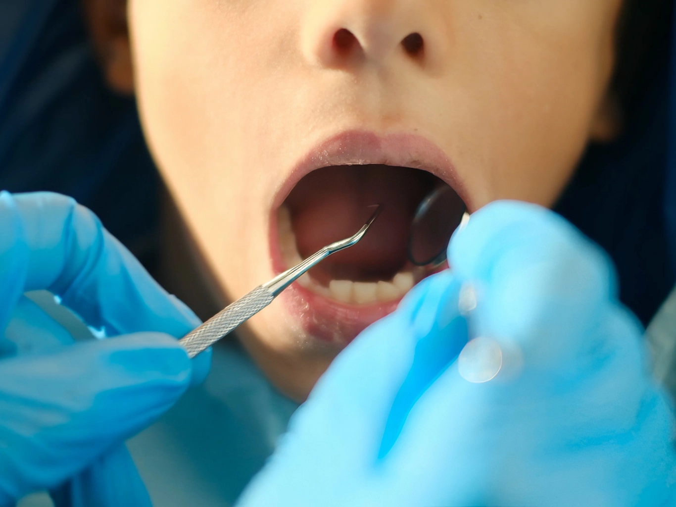 controllo-visita-dentistica-seregno
