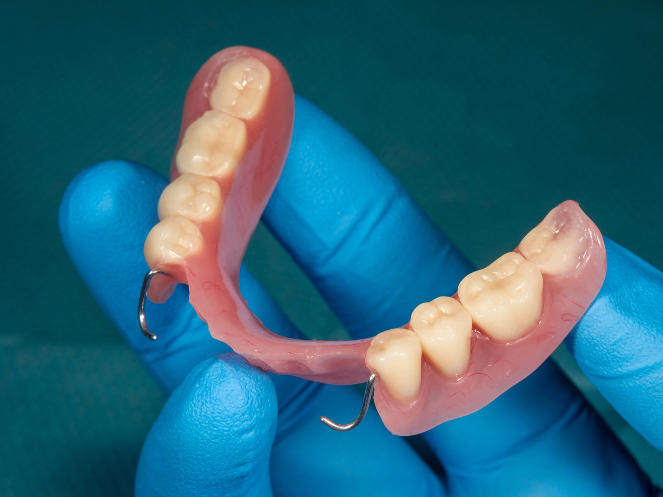 dentiere-ponti-corone-protesi-dentali-cantù