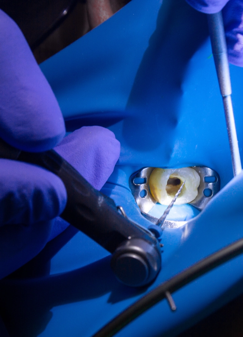 endodonzia-dentale-monza-brianza-seregno