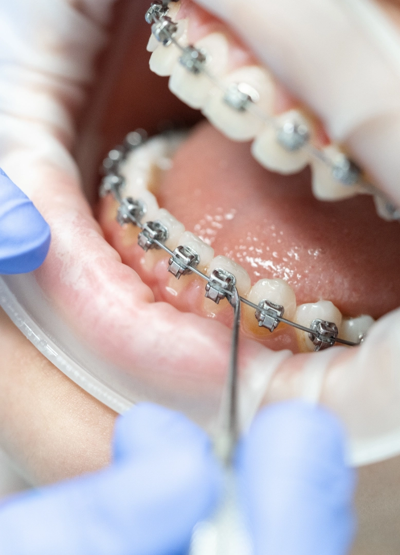 ortodonzia-dentale-monza-brianza-seregno